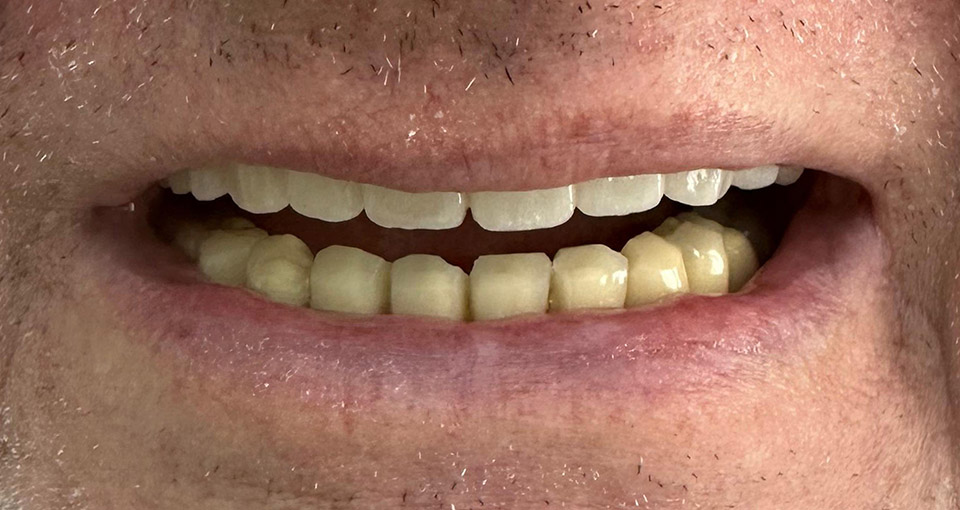 Pacientul înainte de procedură