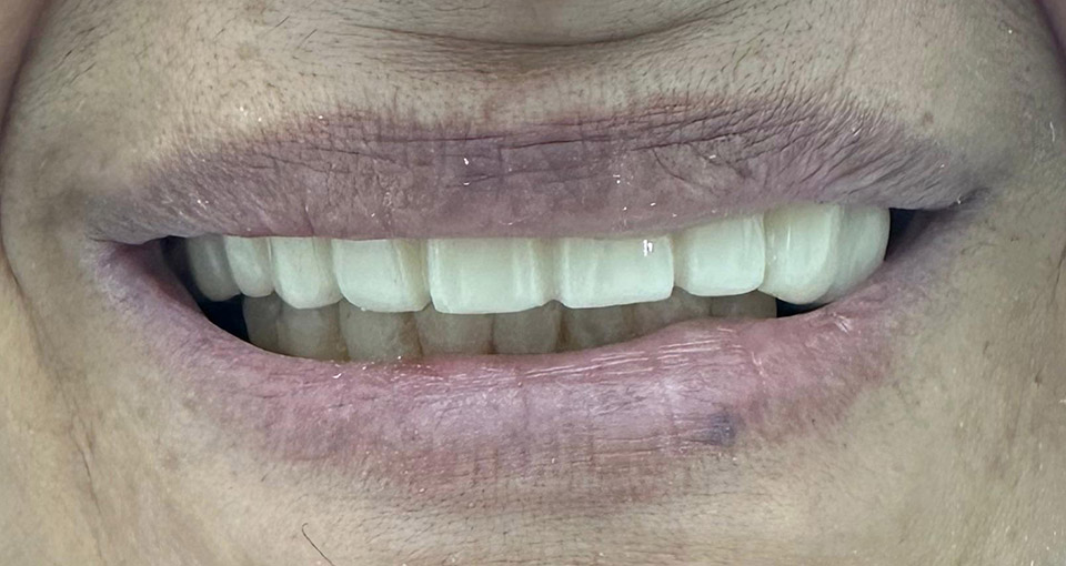 Pacientul înainte de procedură