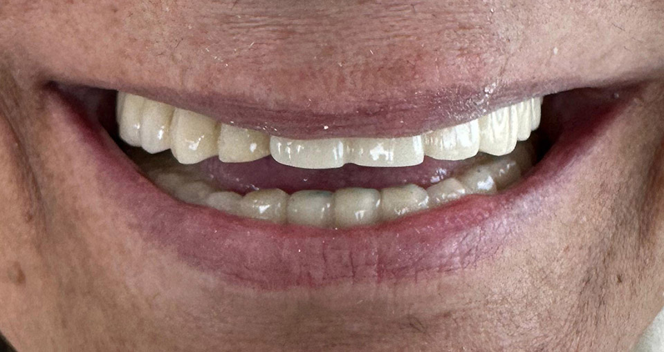 Pacientul înainte de procedură